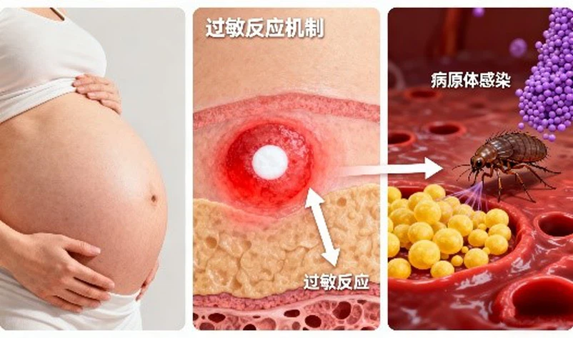 Pregnancy And Flea Treatment Risks | Shaanxi Bloom Tech Pregnancy And Flea Treatment Risks | Shaanxi Bloom Tech