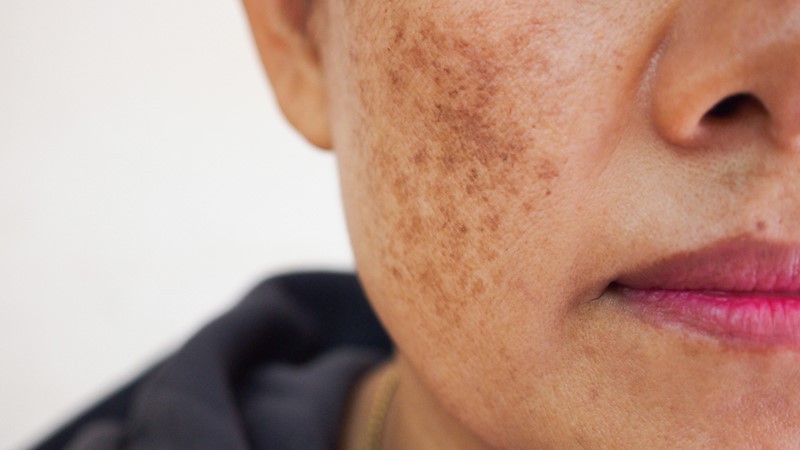 Glutathione Injection price | Shaanxi BLOOM Tech Co., Ltd Glutathione Injection price | Shaanxi BLOOM Tech Co., Ltd